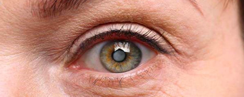 implant oculaire cataracte vision cause chirurgiens ophtalmologues paris centre ophtalmologique ophtalmologie paris est implant oculaire cataracte vision cause chirurgiens ophtalmologues paris centre ophtalmologique ophtalmologie paris est