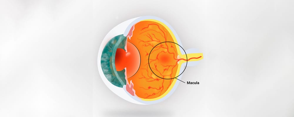 membrane epiretinienne symptomes causes laser chirurgien ophtalmologue specialiste de la retine centre ophtalmologiste ophtalmologie paris est membrane epiretinienne symptomes causes laser chirurgien ophtalmologue specialiste de la retine centre ophtalmologiste ophtalmologie paris est