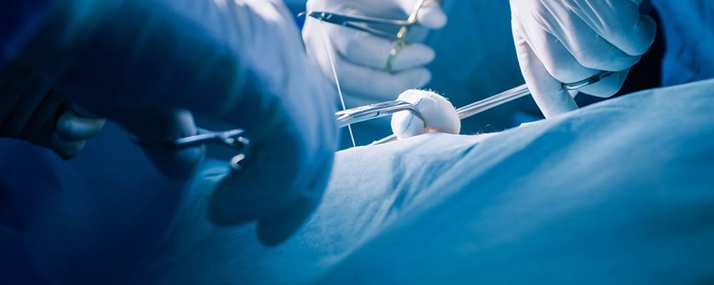 operation tumeur paupiere chirurgien ophtalmologue chirurgie paupiere centre ophtalmologiste ophtalmologie paris est operation tumeur paupiere chirurgien ophtalmologue chirurgie paupiere centre ophtalmologiste ophtalmologie paris est