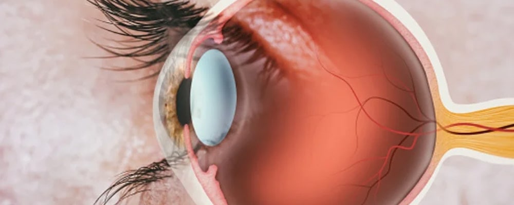 operation de la retine avis chirurgien ophtalmologue specialiste de la retine centre ophtalmologiste ophtalmologie paris est