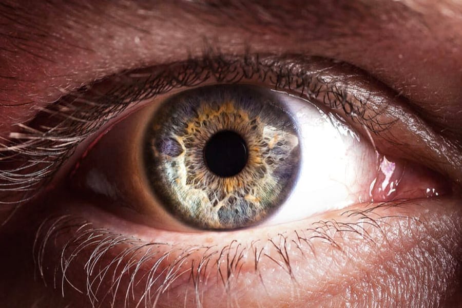 decollement du vitre que faire chirurgien ophtalmologue specialiste cataracte centre ophtalmologiste ophtalmologie paris est