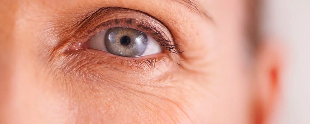 botox pattes d oie avant apres oeil chirurgien ophtalmologue specialiste glaucome centre ophtalmologiste ophtalmologie paris est botox pattes d oie avant apres oeil chirurgien ophtalmologue specialiste glaucome centre ophtalmologiste ophtalmologie paris est