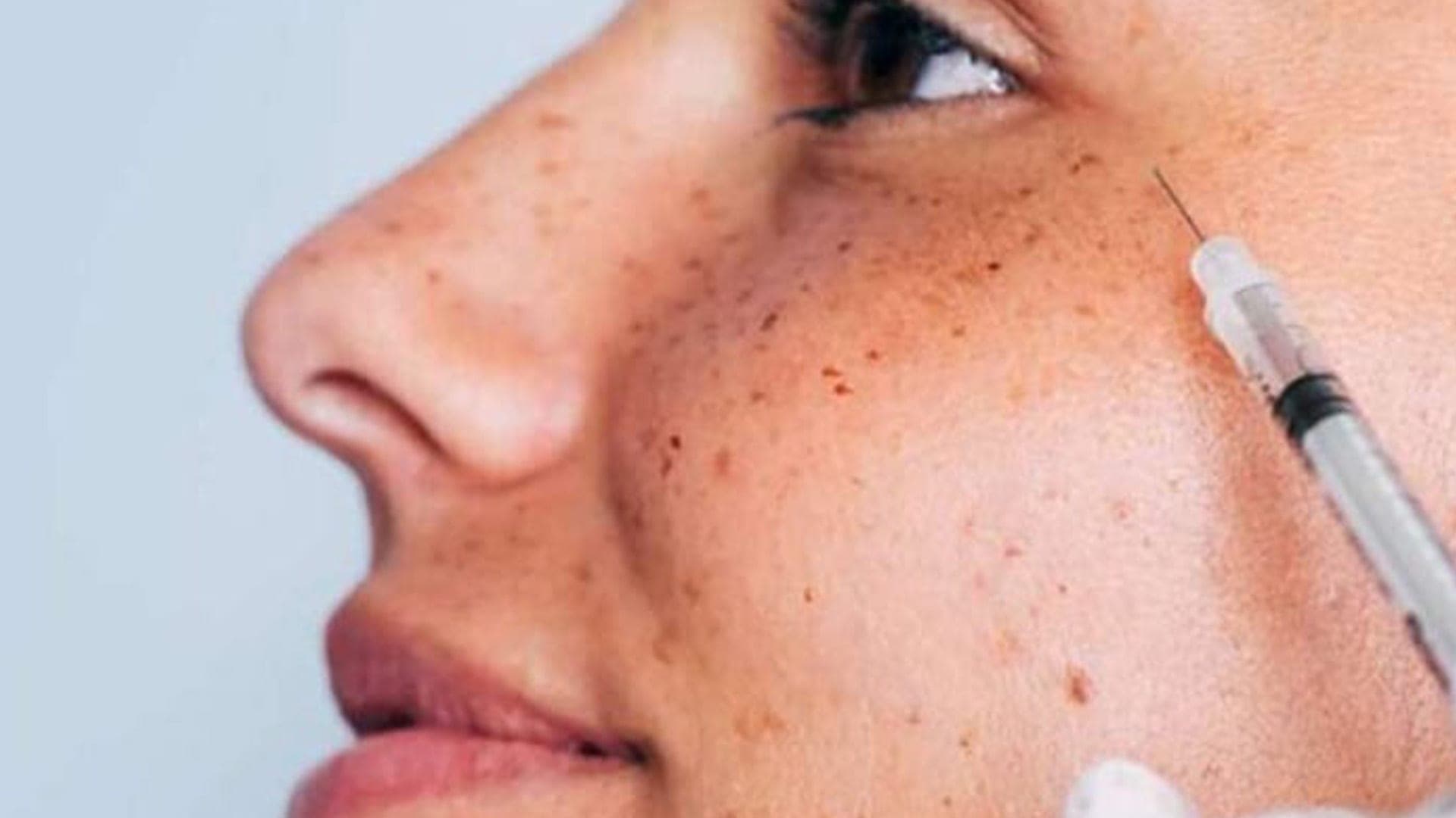 botox paris chirurgien ophtalmologue specialiste medecine esthetique centre ophtalmologiste ophtalmologie paris est botox paris chirurgien ophtalmologue specialiste medecine esthetique centre ophtalmologiste ophtalmologie paris est
